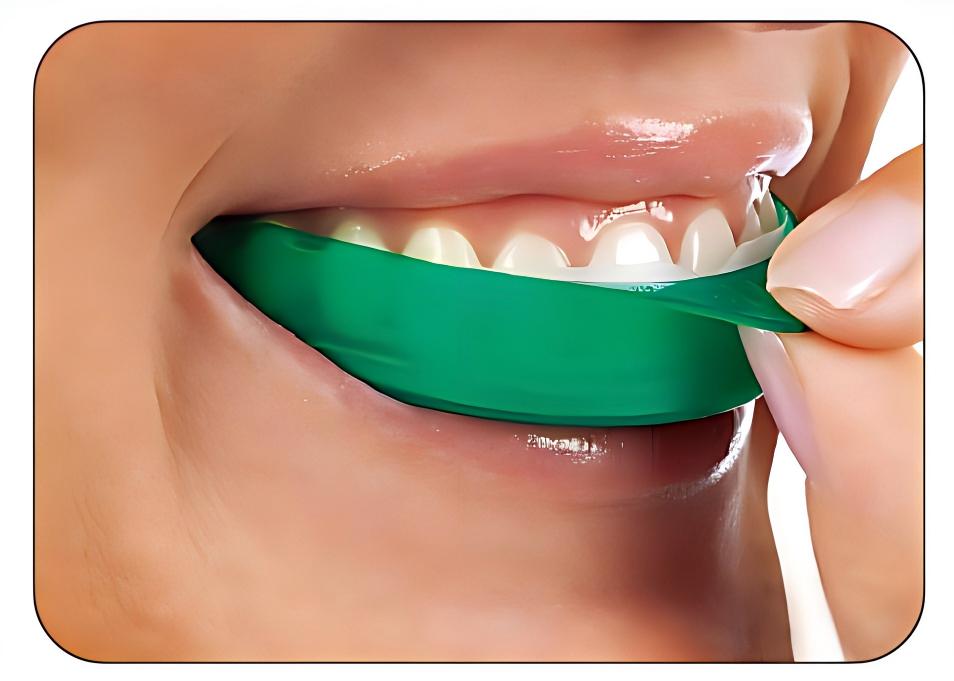 Ultradent Opalescence Go Teeth - Teeth Whitening Opalescence Go review and price