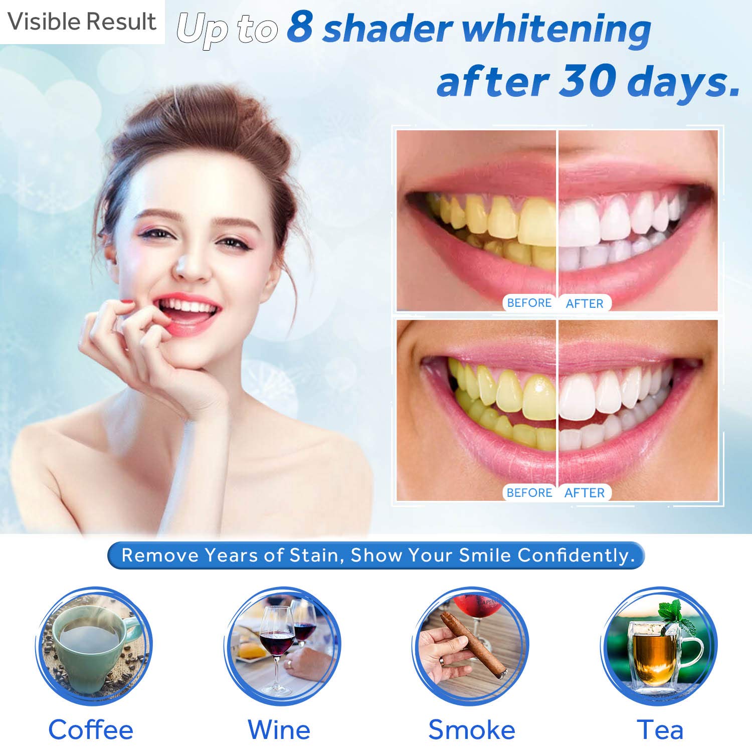 Teeth Whitening Gel Refill Syr - Teeth Whitening Paste review and price