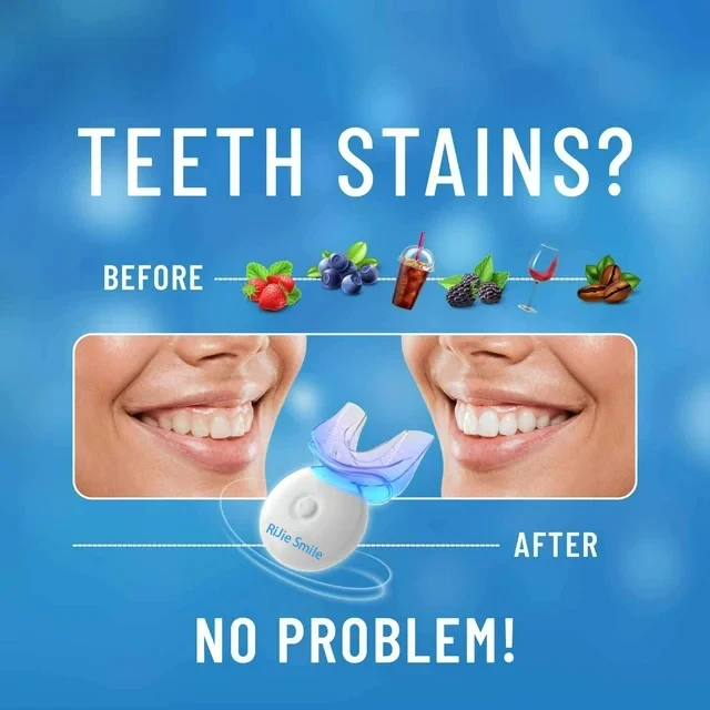 High Quality Cleaning Kit Wire - Teeth Whitening At Home Kit review and price