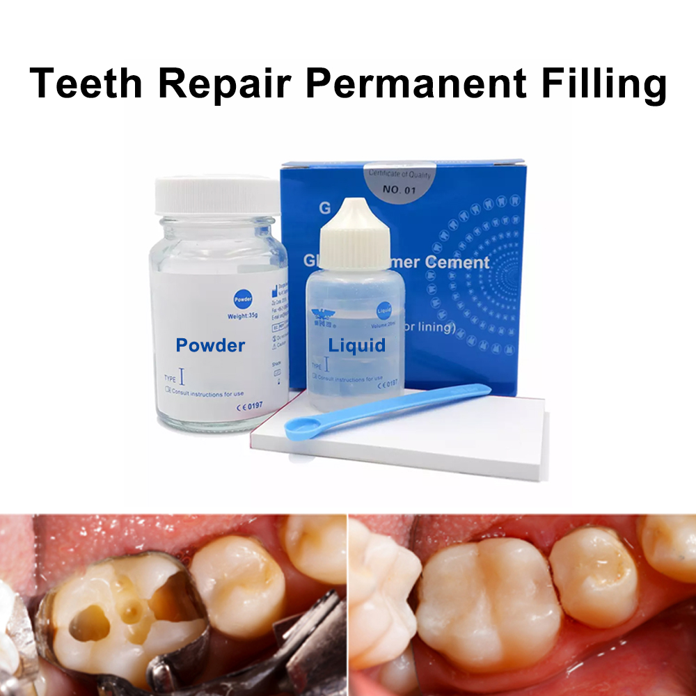 Permanent Teeth Filling Repair - Teeth Whitening At Home Kit review and price