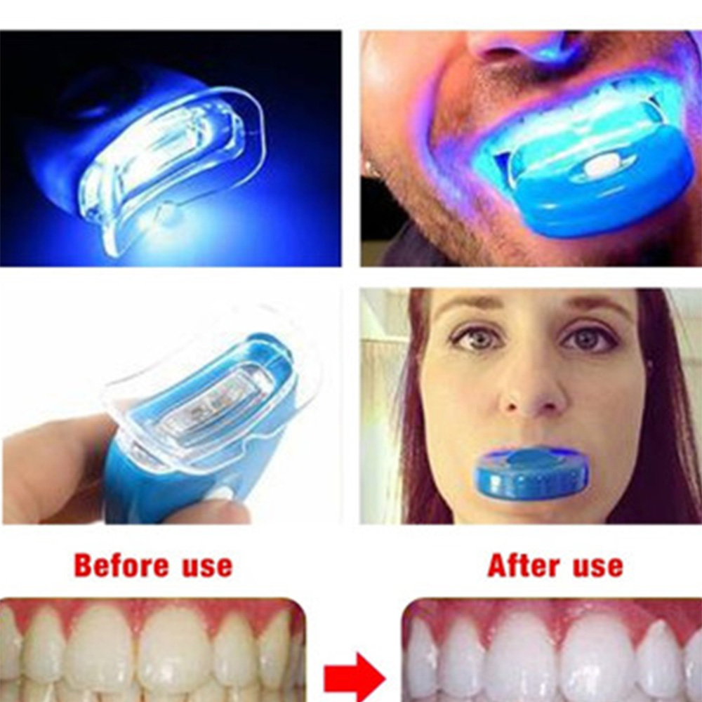 New Blue Led Teeth Whitening A - Teeth Whitening Uv Kit review and price