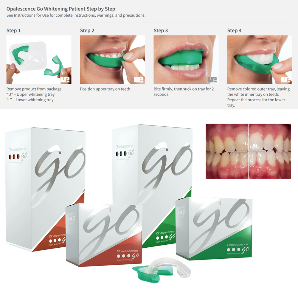 Opalescence Go Teeth Whitening - Teeth Whitening Opalescence Go review and price