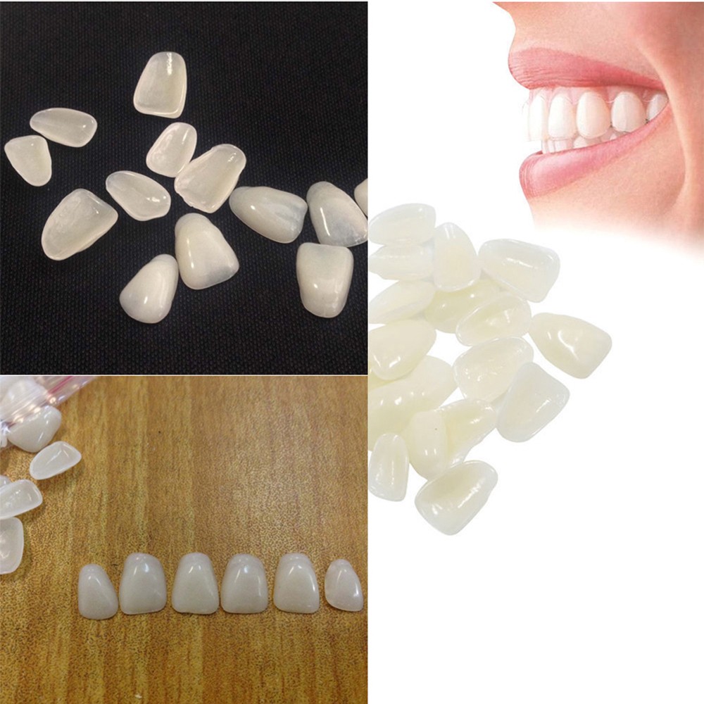 70PCS/Package Beauty Veneers W - Teeth Whitening Veneers review and price
