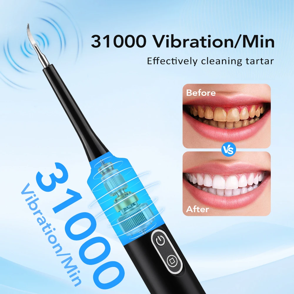 Electric Sonic Vibration Denta - Teeth Whitening Express review and price