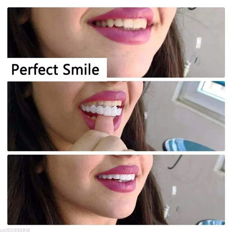 Snap-on Veneer Teeth Kit Adjus - Teeth Whitening Veneers review and price